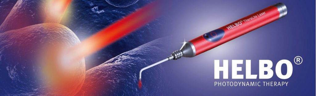 HELBO lézer készülék elérhető kezelés a szekszárdi Mosolyrendelő fogászatán.